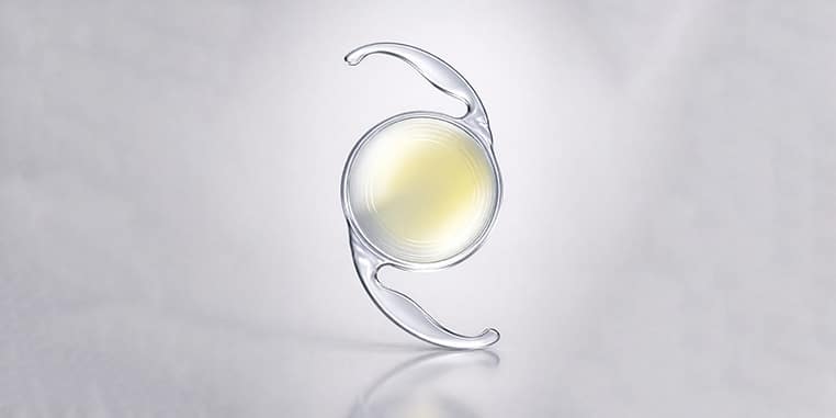 Toric Lenses